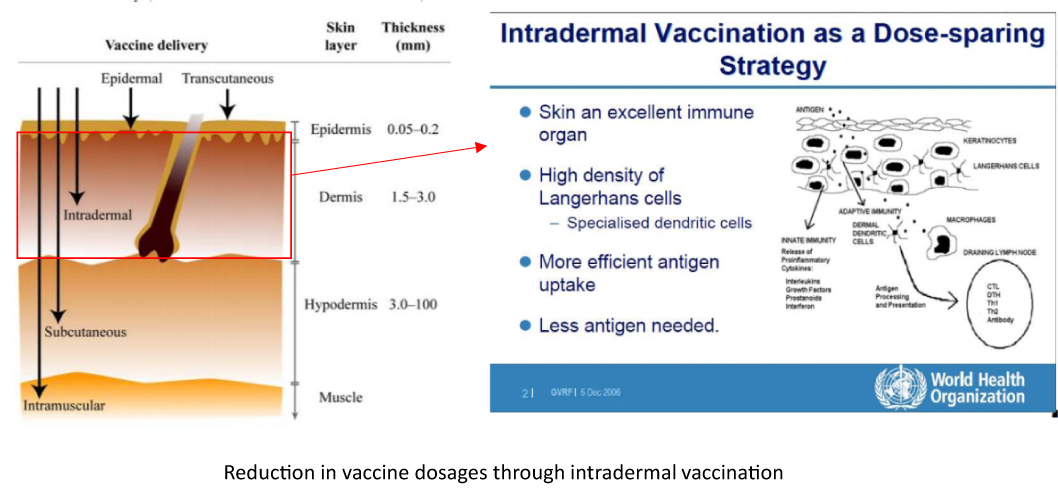 ワクチンの皮内投与の為のデバイスイメージ4
