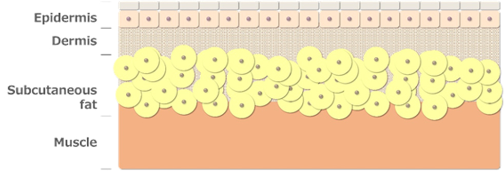 Mechanism of immune induction by intradermal administration