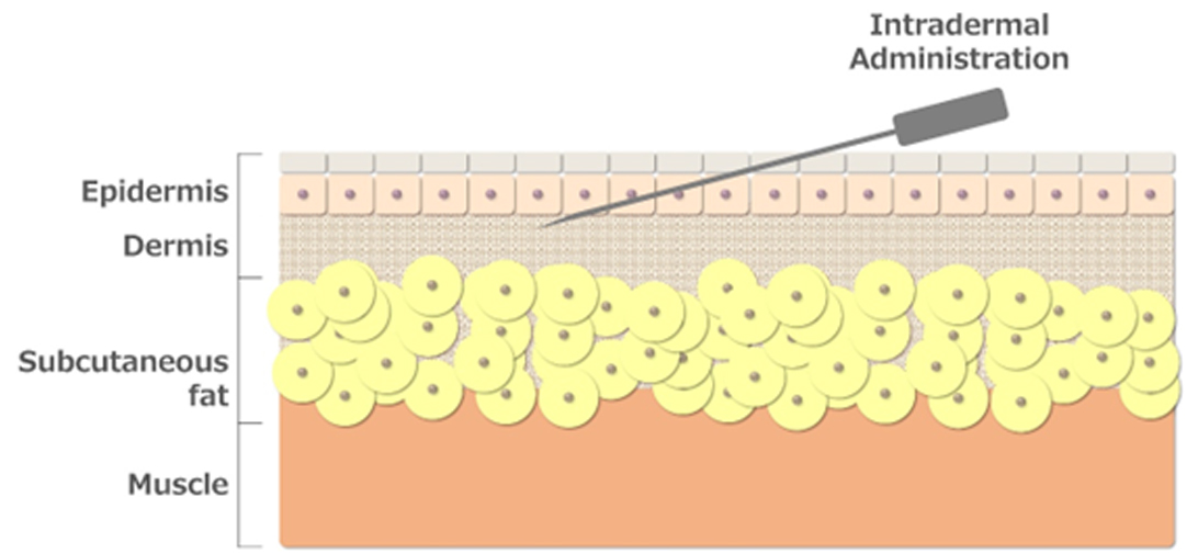 Mechanism of immune induction by intradermal administration