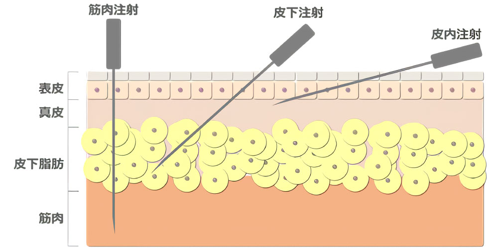 皮内投与による免疫惹起のメカニズムイメージ2